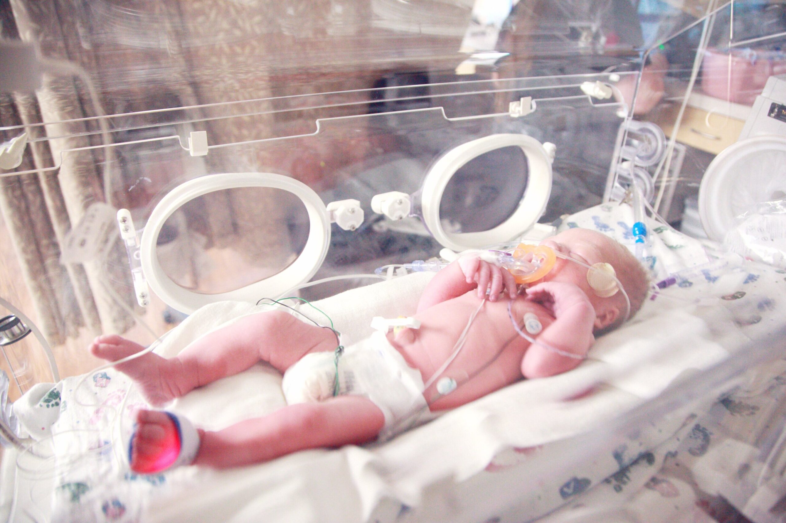 Nash Keen celebra su primer cumpleaños, un hito en la medicina neonatal. Foto: Centro de Salud de la Universidad de Iowa. Foto: Unplash