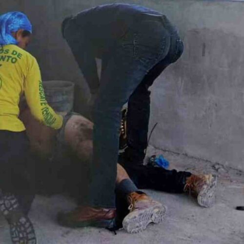 HERIDO. Las quemaduras, que incluyen ampollas y daño profundo, requieren atención médica. Autoridades informan del incidente. Cortesía.