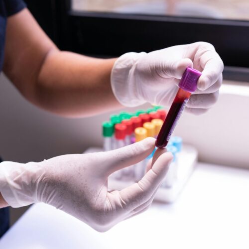 Los análisis de sangre son clave para monitorear la salud después de los 40 años. Foto: Cristian Rojas