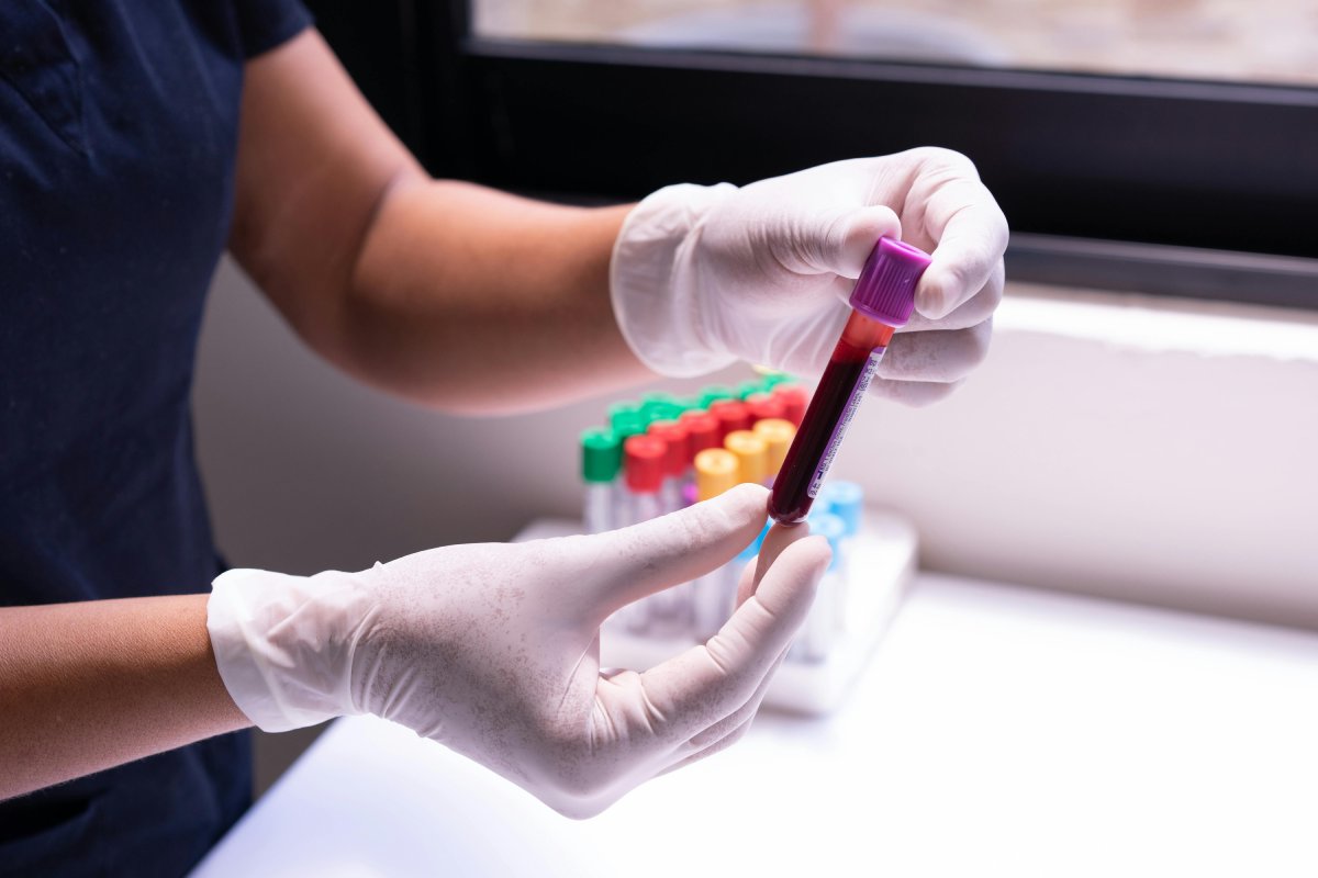 Los análisis de sangre son clave para monitorear la salud después de los 40 años. Foto: Cristian Rojas