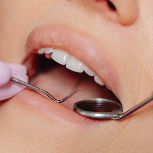 La endodoncia, además de salvar dientes, ayuda a reducir el riesgo de diabetes y enfermedades cardíacas, según un estudio reciente. Foto: Pexels / Karola G.