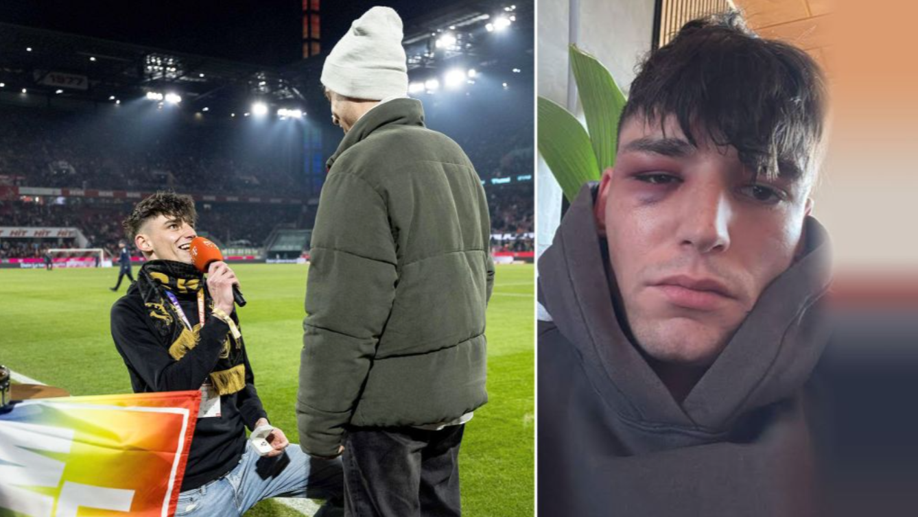 El árbitro Pascal Kaiser sufrió un brutal ataque en su hogar tras pedir matrimonio a su pareja en la Bundesliga. El caso ha generado condena internacional por homofobia y violencia. Foto: Pascal Kaiser / Redes Sociales.