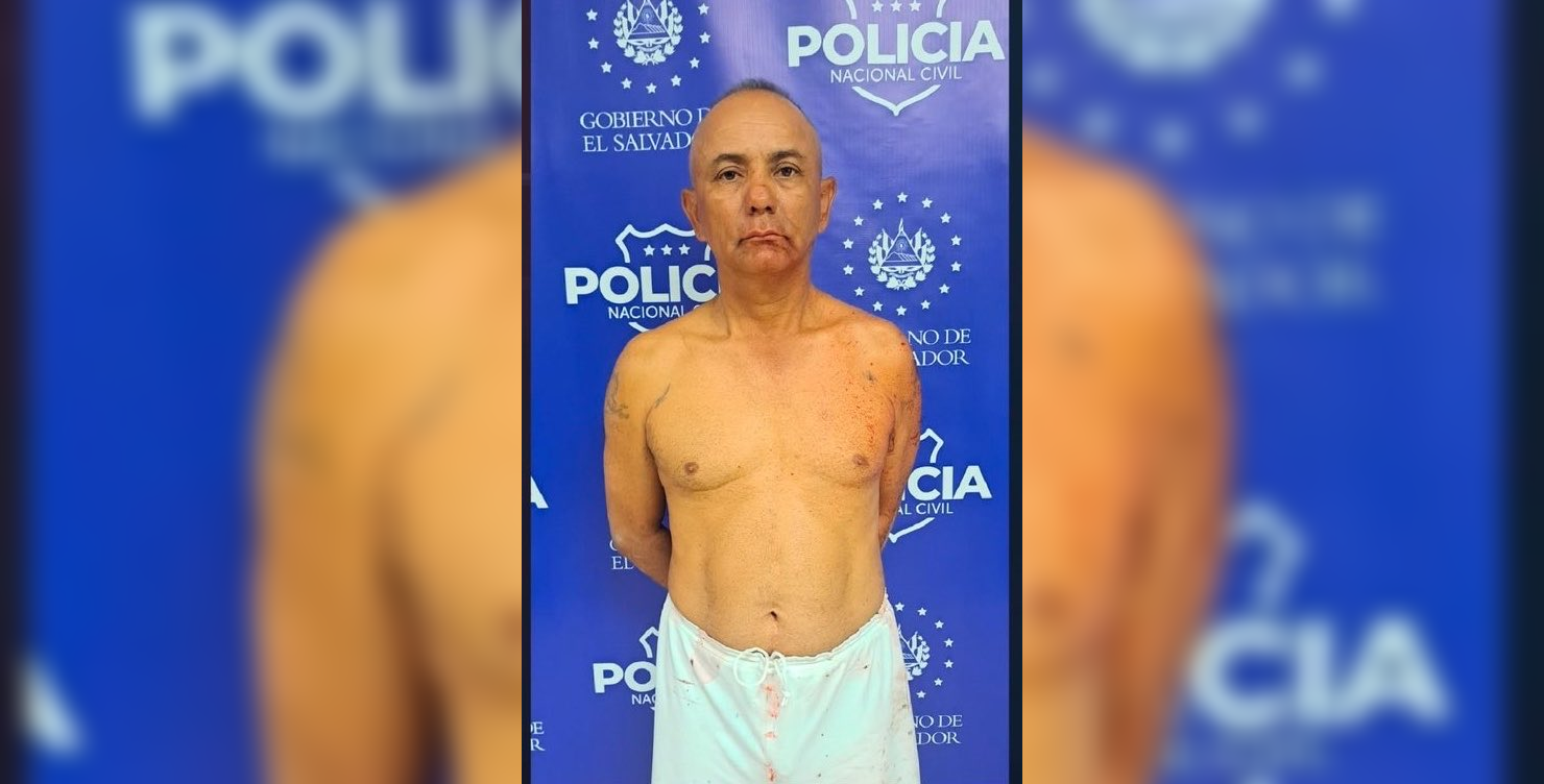 Detenido por intento de homicidio: Ebrio disparó a su hijo de 17 años en Colón