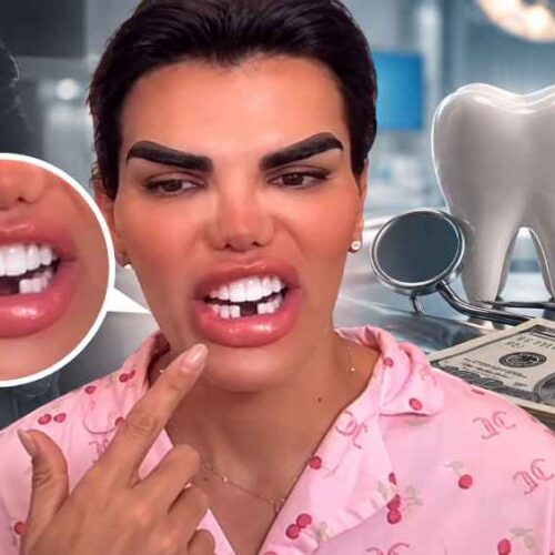 René Valdivieso relató en redes la experiencia que asegura haber vivido durante un procedimiento dental y su reacción al ver las nuevas piezas. Foto: Ilustración.