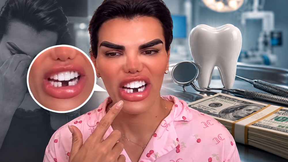 René Valdivieso relató en redes la experiencia que asegura haber vivido durante un procedimiento dental y su reacción al ver las nuevas piezas. Foto: Ilustración.