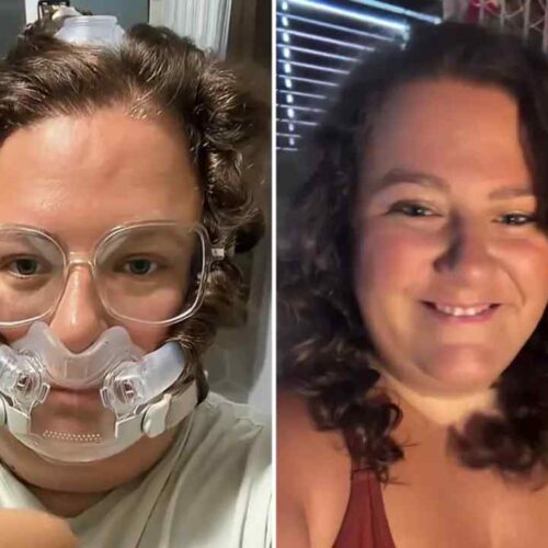 Rogue Schmidt comparte su experiencia con una mascarilla CPAP y promueve una imagen positiva de las personas que reciben tratamiento para la apnea del sueño.